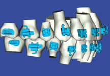 SureSmile Digital Orthodontic Treatment Planning