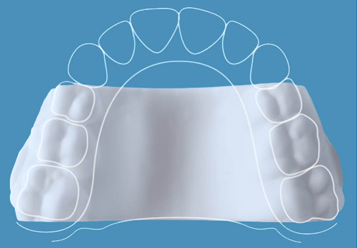 Expander